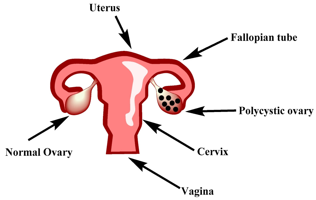 PCOS Destroyer Herbal Tea Blend (loose herbs)