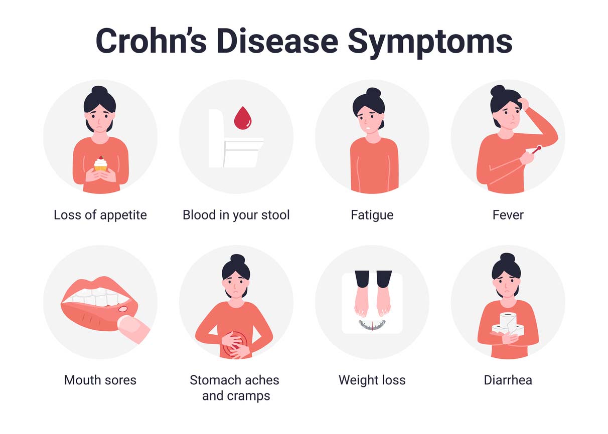 Crohn's Disease Relief Tea (loose herbs)