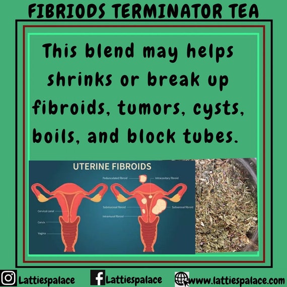 Fibroids Terminator Herbal Tea Blend
