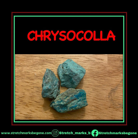 CHRYSOCOLLA Raw Gemstones - Stretchmarksbegone