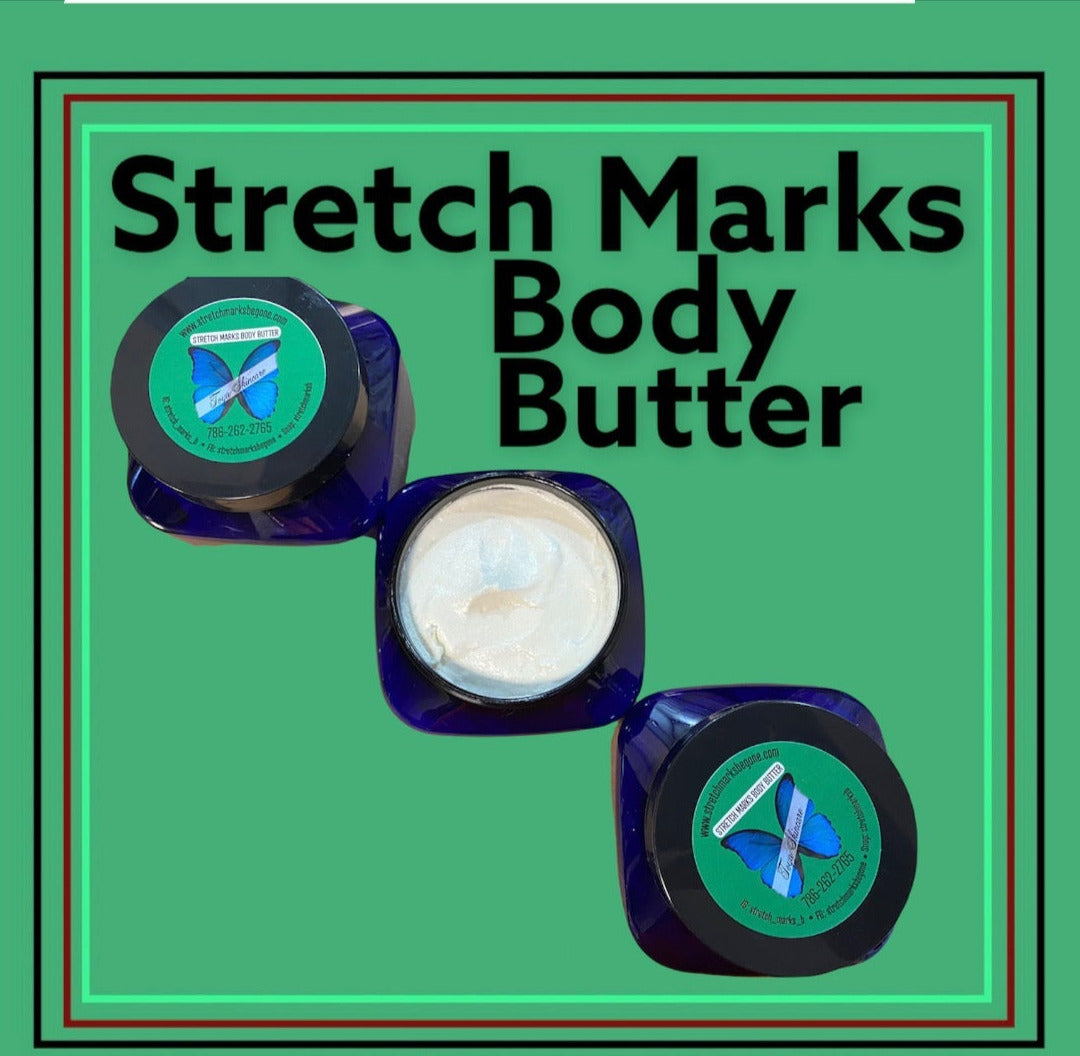 Lavender Stretch Marks Body Butter - Stretchmarksbegone