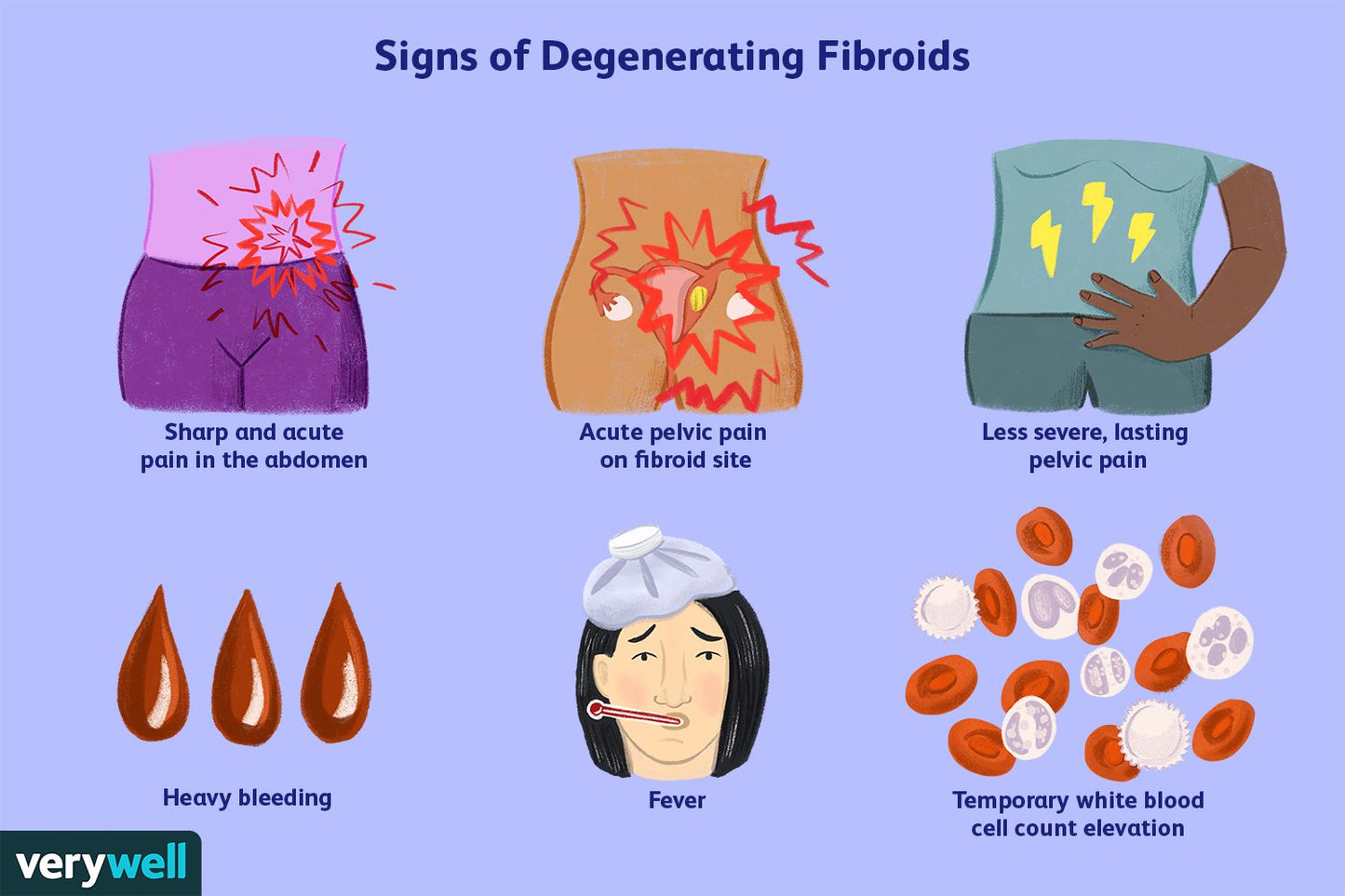 Fibroids Terminator Herbal Tea Blend